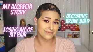 My Alopecia Story. How I Lost ALL Of My Hair