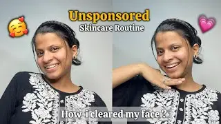 My Honest Night Skincare Routine For Clear Skin | Tips for Glowing skincare and product faves 🧴🫧🧖&zwj;♀️