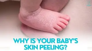 Why Is Your Baby&rsquo;s Skin Peeling? Causes & How to Prevent It!