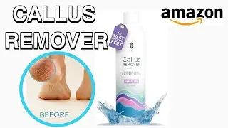 HOW TO USE LEE BEAUTY PROFESSIONAL CALLUS REMOVER FOR FEET | AMAZON FINDS!! 👣