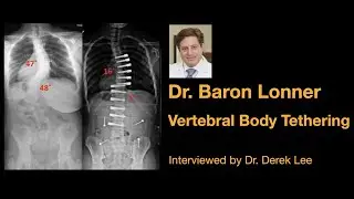 Dr. Baron Lonner, Vertebral Body Tethering (VBT),  interviewed Dr. Derek Lee