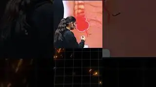 Appendix क्या होता हैं 🤔🤔 #science #rrbntpc #shortsviral #short