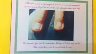Onychophagy art gallery/ Galerie d'art Onychophagie