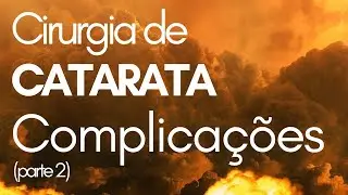 Dr. Lucas | Complicações da Cirurgia de Catarata - Pós operatório