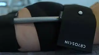 Tutorial 3: Step-by-Step with Cryoskin - Static Treatments
