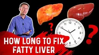 How Long Does It Take to Fix Fatty Liver? &ndash; Dr. Berg