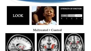 Dr. Kate McLaughlin at UNC Neuroscience of Youth Depression Conference
