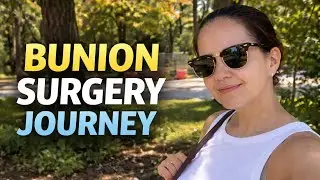 Thinking about bunion surgery? Join me for the full experience and story! #bunions #bunionsurgery  
