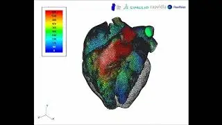 FlowVision CFD   Blood Velocity Volume Visualization in LHHM, 1 Way FSI 161128