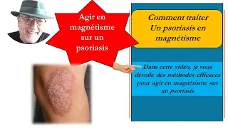 Comment soulager un psoriasis gr&acirc;ce au magn&eacute;tisme | Cours de magn&eacute;tiseur Cours de magn&eacute;tisme