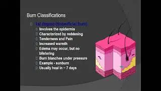 Topic 10 : Thermal Injury
