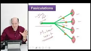 Lower motor neuron lesion