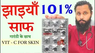 ✅ no 1 - Vit C  FOR PIGMENTATION  🥝 VIT C FOR MELASMA , Limcee for skin !! Dr Prateek chauhan