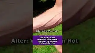 Veins Before and After (Popping Out) Getting Hot | Vasoconstriction vs Vasodilation