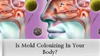 Fungal Identification Medical Test Mold Sickness from Mold Exposure