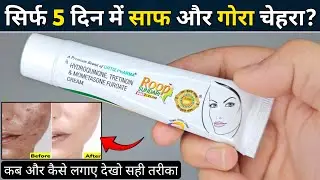 Roop Sundari Cream | roop sundari gold cream | roop sundari cream se kya hota hai