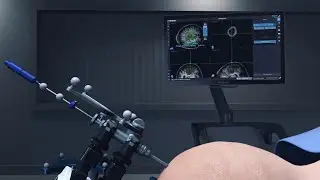 Niphkeys 3d medical animation video
