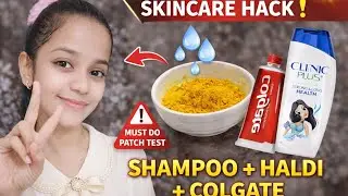 Internet ka most viral skincare hack ✨🤷Shampoo + Haldi + Colgate🤯But patch test is MUST #skincare