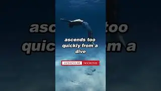 Why does decompression sickness lead to femoral head necrosis?