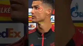 RONALDO'NUN Y&Uuml;Z&Uuml;NDEKI YARA İZİ NEDEN VAR 🤯😱 #shorts #short #football #ronaldo