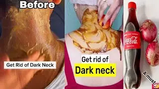 TRY THIS/ TURMERIC & TOMATOS TO LIGHTENING DARK NECK GET RID OF DARK NECK IN 5 MINUTES QUICK