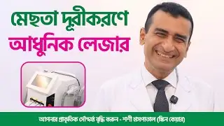 মেছতা দূরীকরণে আধুনিক লেজার ট্রিটমেন্ট | Melasma Treatment in Bangladesh | SUO XI Hospital-Skin Care