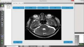 Medical Annotation tool video V1.0 Using Qt GUI framework