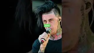 Evolution of Ronnie Radke