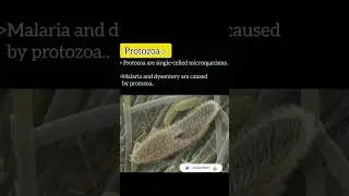 short notes on protozoa|| short notes|| #shorts #shortsviral
