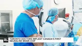 Toronto doctors implant Canada's first Neuralink Brain Chip