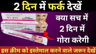 Best Cream Gore Hone Ki | 7 दिन में गोरा होना है तो यह क्रीम अपने पास जरूर रखें | Skin Whitening