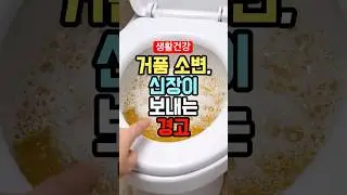 소변 거품이 사라지지 않는다면 꼭 검사하세요! / Persistent Foamy Urine? Get Tested