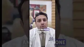 When I Refuse Knee Replacement Surgery | Orthopedic Surgeon Explains