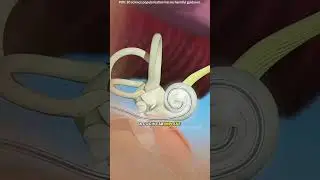 How cochlear implant works?(3D animation) #drone #theflash #space #automobile #scifi #spaceflight