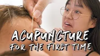 MY FIRST TIME - ACUPUNCTURE #EP2