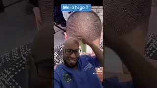 Quienes aplican para colocarse una peluca en condiciones de calvicie ? #calvos #shortsvideo #follow