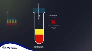 The Journey of a Laboratory Sample During Hemostasis Testing @Werfen_NA | ANTISEL