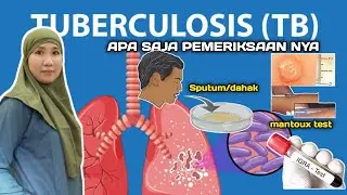 Pemeriksaan untuk penderita TBC 