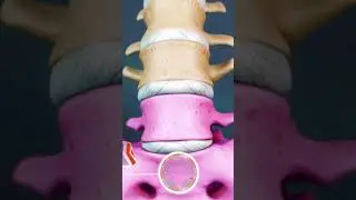 L4-L5 and L5-S1 disc problems