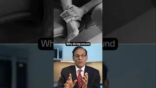 Why Leg Wounds Heal Slowly | Poor Circulation, Diabetes & Slow Healing Explained