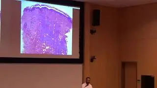 Sarcoidosis Skin Concerns- Misha Rosenbach