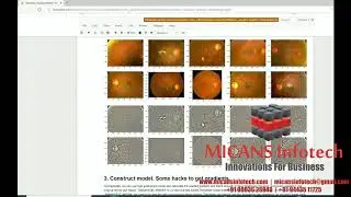 Detecting Blindness python project using Densenet - CNN