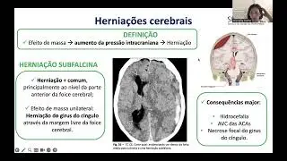 Imagiologia Cerebral e Patologias Associadas - Parte 2