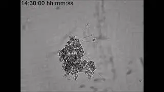 Quantitative analysis of melanin content in a three-dimensional melanoma cell culture