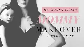 Mommy Makeover Liposuction | Orange County Plastic Surgeon