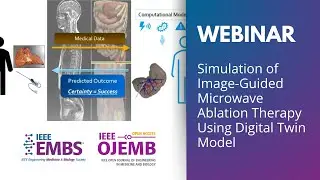 Simulation of Image-Guided Microwave Ablation Therapy Using Digital Twin Model | IEEE OJEMB Webinar