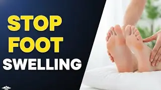 Relieve Foot Swelling Overnight: Magnesium, Massage & Exercises