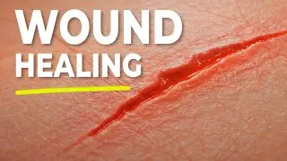 How Your Body Heals Wounds & Cuts | 3D Animation