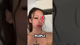 💋 Why Do Some People&rsquo;s Lips Get Swollen? 🔥😮