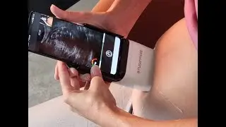 Home Ultrasound check that actually saves lives – Pulsenmore